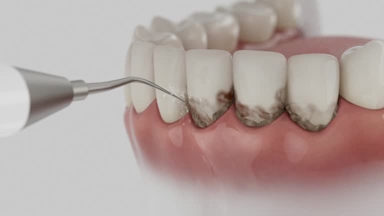 Reliable Dental Implants contractor in Burnham, IL by Smile Center Dentistry